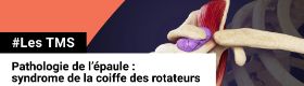 TMS - Pathologie de l'épaule - Syndrome de la coiffe des rotateurs