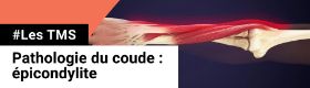 TMS - Pathologie du coude - Epicondylite