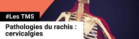 TMS - Cervicalgie