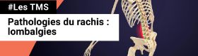 TMS - Lombalgie