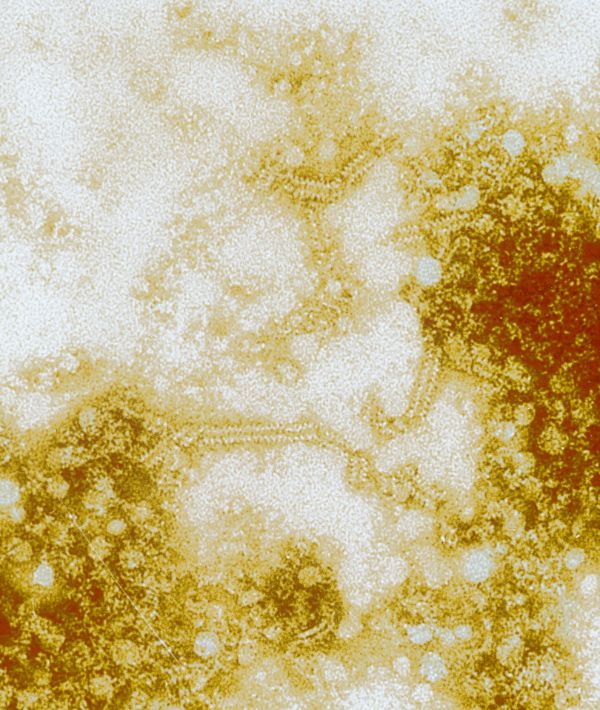 Virus des oreillons