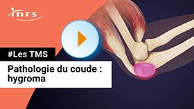 TMS - Pathologie du coude - Hygroma