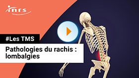 TMS - Lombalgie
